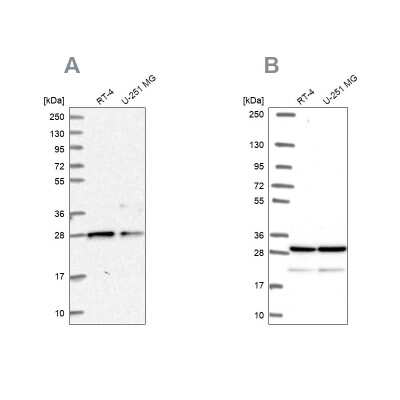 Western Blot: PGRMC2 Antibody [NBP2-13753]
