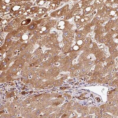 Immunohistochemistry-Paraffin: PGLYRP2/PGRP-L Antibody [NBP2-32042]
