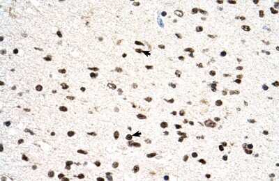 Immunohistochemistry: PGS1 Antibody [NBP2-88040]