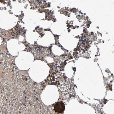 Immunohistochemistry-Paraffin: PGS1 Antibody [NBP1-85022]