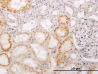 Immunohistochemistry-Paraffin: PHACS Antibody (1D2) [H00084680-M02]