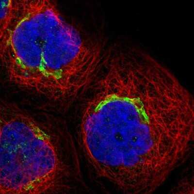 Immunocytochemistry/ Immunofluorescence: PHACS Antibody [NBP1-90260]