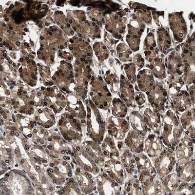 Immunohistochemistry-Paraffin: PHACS Antibody [NBP1-90259]