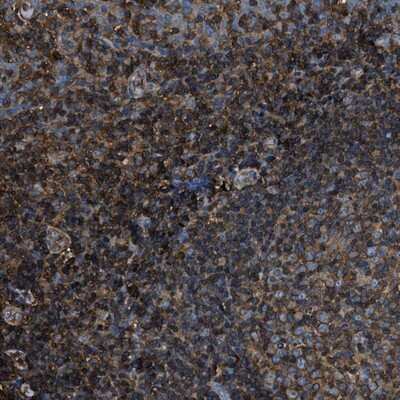 Immunohistochemistry-Paraffin: PHACS Antibody [NBP1-90260]