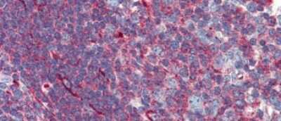 Immunohistochemistry-Paraffin: PHACTR1 Antibody [NBP1-56787]