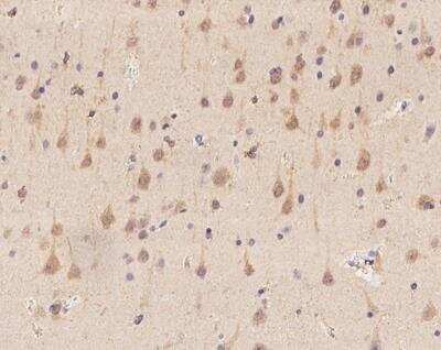 Immunohistochemistry-Paraffin: PHACTR3 Antibody [NBP3-12697]
