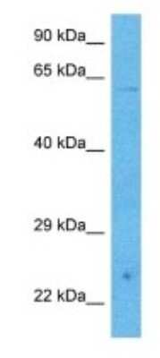 Western Blot: PHACTR3 Antibody [NBP3-09933]