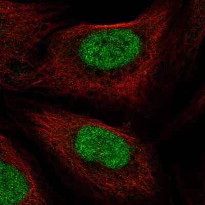 Immunocytochemistry/ Immunofluorescence: PHAX Antibody [NBP2-55912]
