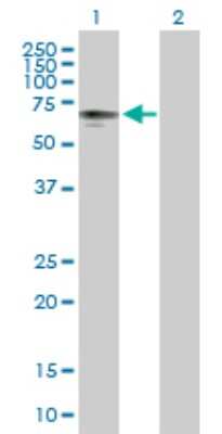 Western Blot: PHD4/HIF Prolyl Hydroxylase 4 Antibody [H00054681-B01P]