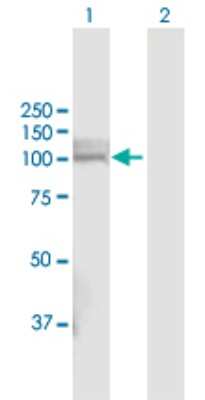 Western Blot: PHEX Antibody [H00005251-D01P]