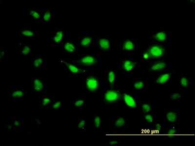 Immunocytochemistry/ Immunofluorescence: PHF1 Antibody (2G7) [H00005252-M04]