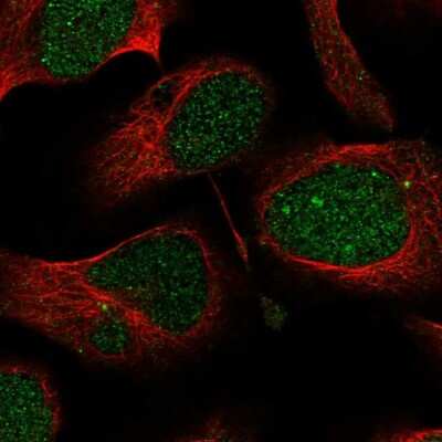 Immunocytochemistry/ Immunofluorescence: PHF1 Antibody [NBP1-82613]