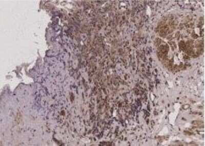 Immunohistochemistry: PHF1 Antibody [NBP1-82613]