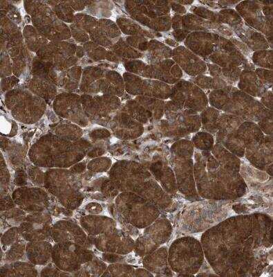 Immunohistochemistry-Paraffin: PHF1 Antibody [NBP1-82613]