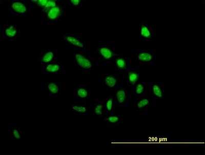 Immunocytochemistry/ Immunofluorescence: PHF10 Antibody [H00055274-B01P]