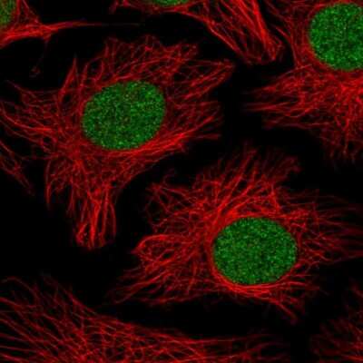 Immunocytochemistry/ Immunofluorescence: PHF10 Antibody [NBP2-33759]