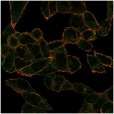 Immunocytochemistry/ Immunofluorescence: PHF10 Antibody (PCRP-PHF10-2A10) [NBP3-13750]