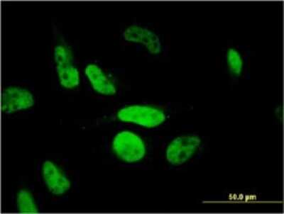 Immunocytochemistry/ Immunofluorescence: PHF11 Antibody (3B8) [H00051131-M01]