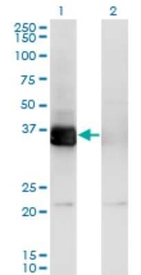 Western Blot: PHF11 Antibody (3B8) [H00051131-M01]