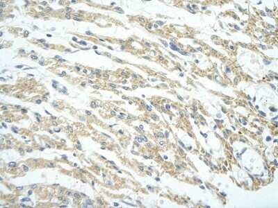 Immunohistochemistry: PHF11 Antibody [NBP1-80054]