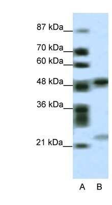 Western Blot: PHF11 Antibody [NBP1-80054]