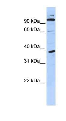 Western Blot: PHF11 Antibody [NBP1-80332]