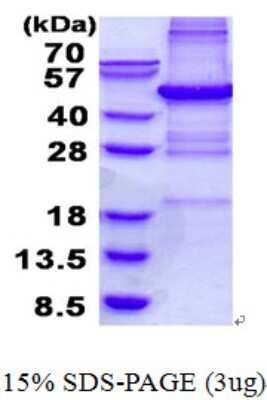 SDS-PAGE: Recombinant Human PHF11 His Protein [NBP2-23323]