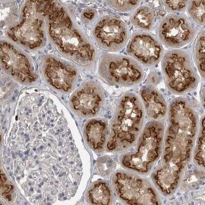 Immunohistochemistry-Paraffin: PHF13 Antibody [NBP1-81077]