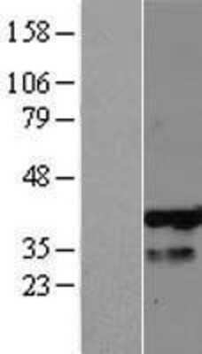 Western Blot: PHF13 Overexpression Lysate [NBL1-14354]