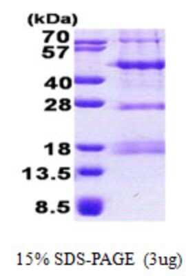 SDS-PAGE: Recombinant Human PHF13 His Protein [NBP2-23324]