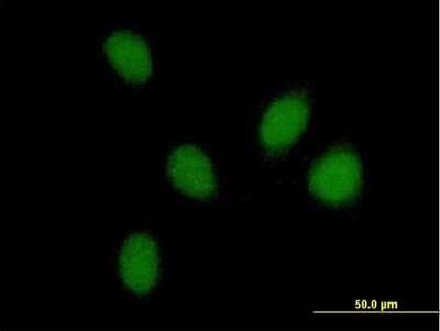 Immunocytochemistry/ Immunofluorescence: PHF16 Antibody [H00009767-B01P]
