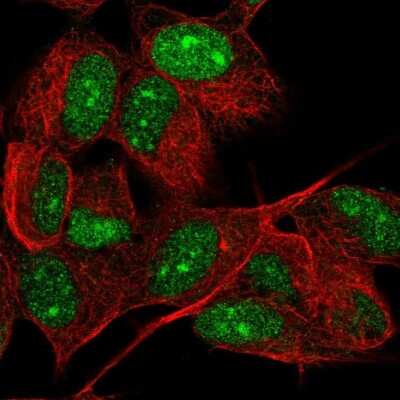 Immunocytochemistry/ Immunofluorescence: PHF16 Antibody [NBP2-55990]
