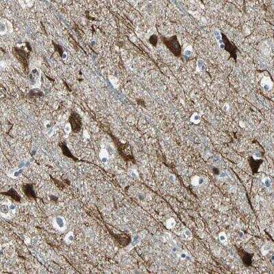 Immunohistochemistry-Paraffin: PHF16 Antibody [NBP1-83022]