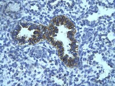 Immunohistochemistry-Paraffin: PHF16 Antibody [NBP3-10323]