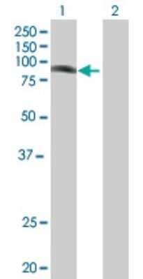 Western Blot: PHF16 Antibody [H00009767-B01P]