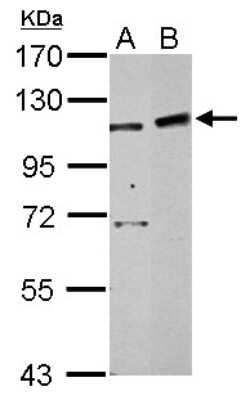 Western Blot: PHF16 Antibody [NBP2-19796]