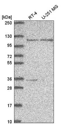 Western Blot: PHF16 Antibody [NBP2-55990]