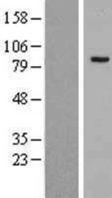 Western Blot: PHF16 Overexpression Lysate [NBP2-08455]