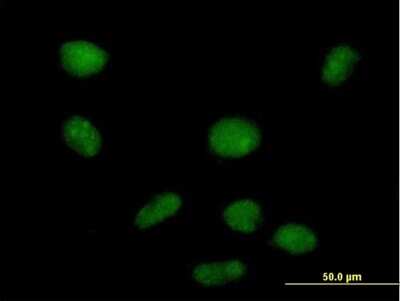 Immunocytochemistry/ Immunofluorescence: PHF19 Antibody [H00026147-B01P]