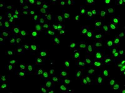 Immunocytochemistry/ Immunofluorescence: PHF19 Antibody - Azide and BSA Free [NBP2-93768]