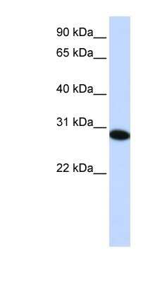Western Blot: PHF19 Antibody [NBP1-79352]