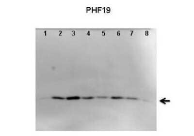 Western Blot: PHF19 Antibody [NBP1-79352]