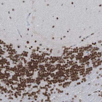 Immunohistochemistry-Paraffin: PHF2 Antibody [NBP1-83080]