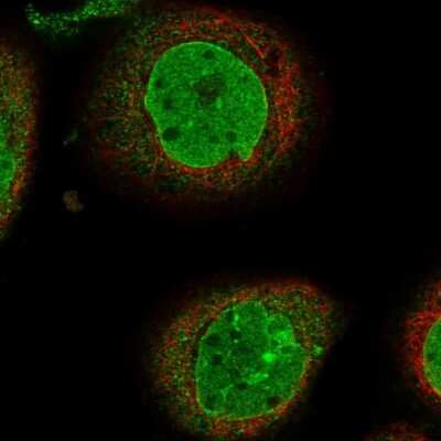 Immunocytochemistry/ Immunofluorescence: PHF20 Antibody [NBP1-88309]