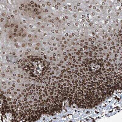 Immunohistochemistry-Paraffin: PHF20 Antibody [NBP1-88309]