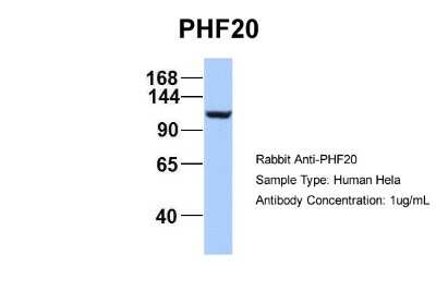 Western Blot: PHF20 Antibody [NBP2-88044]