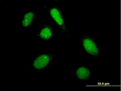 Immunocytochemistry/ Immunofluorescence: PHF20L1 Antibody [H00051105-B01P]