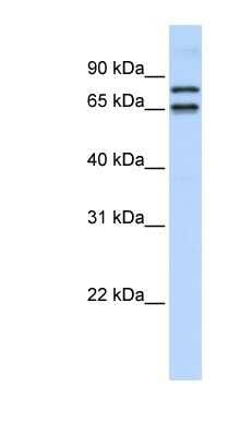 Western Blot: PHF20L1 Antibody [NBP1-79401]