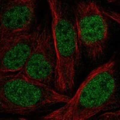 Immunocytochemistry/ Immunofluorescence: PHF21A Antibody [NBP3-17665]