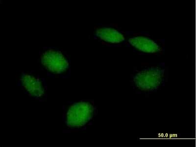 Immunocytochemistry/ Immunofluorescence: PHF21B Antibody [H00112885-B01P]